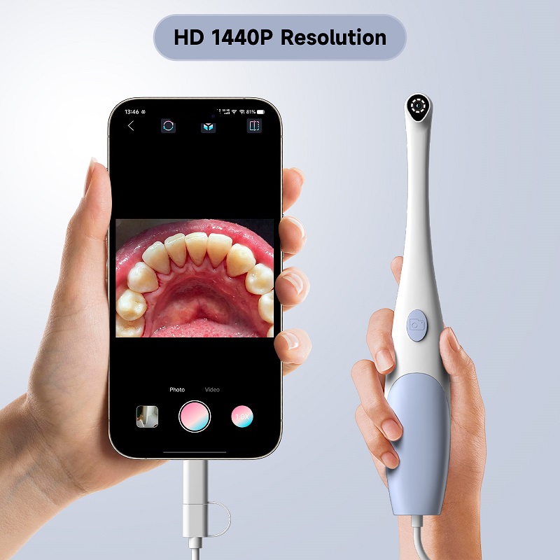 Oral Endoscope Camera 1440P Ph - đánh giá và giá Photography Lighting Description